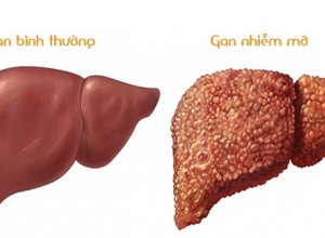 5 Cách Đơn Giản Bảo Vệ Gan, Thận Thúc Đẩy Giải Độc Nên Làm Mỗi Ngày